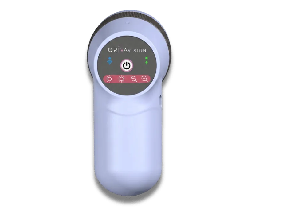 Intelligent Workflow & Visual Control